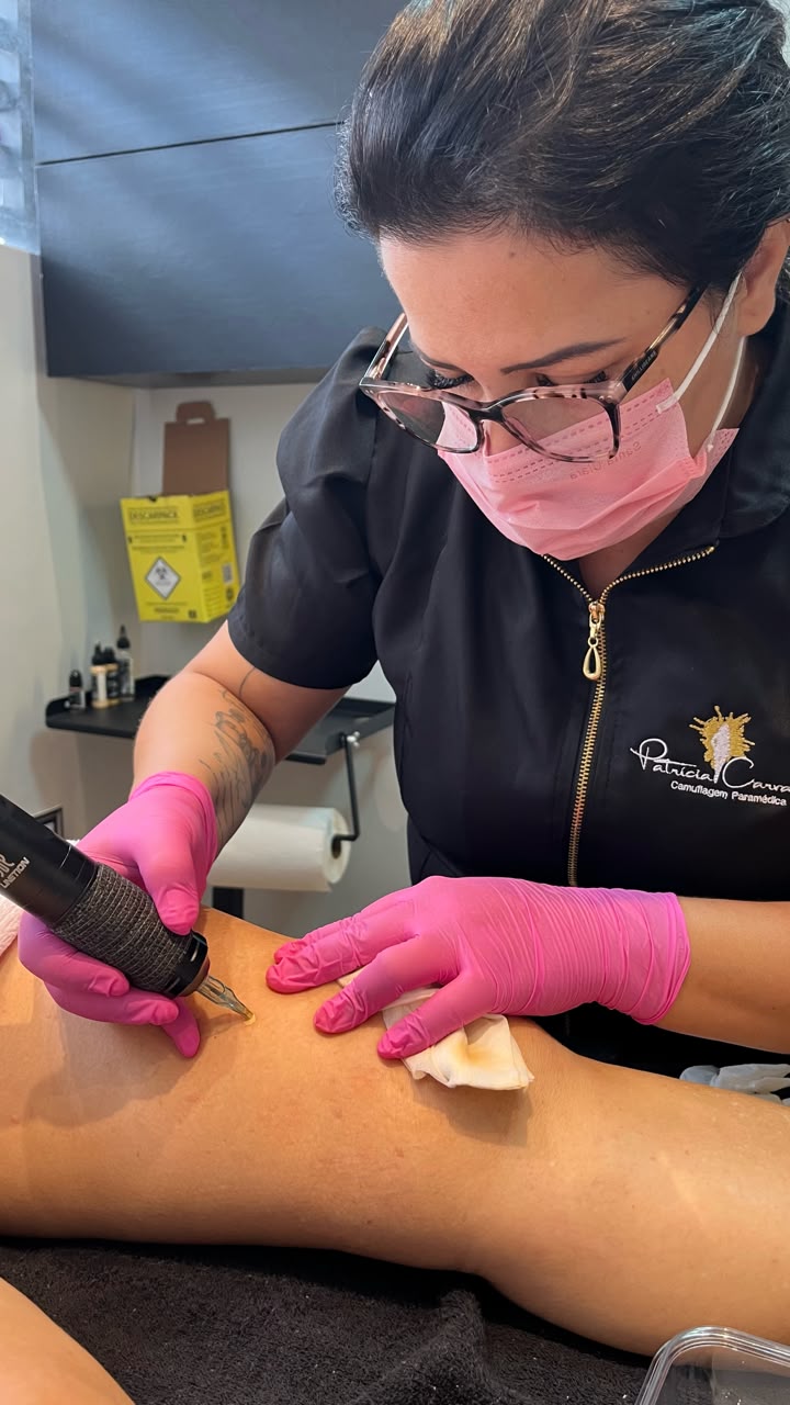 Patrícia Carvalho realizando camuflagem paramédica em close, com dermógrafo e técnica visível na pele